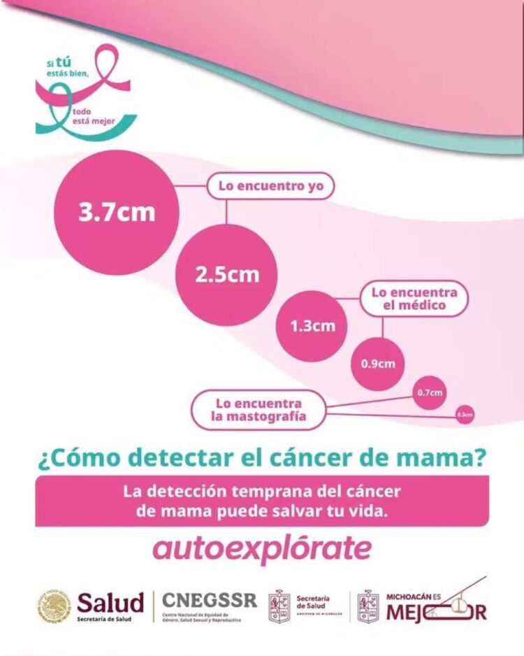 Infografía en tonos rosas y turquesa que muestra tamaños de nódulos detectables en diferentes etapas de revisión para la detección de cáncer de mama.